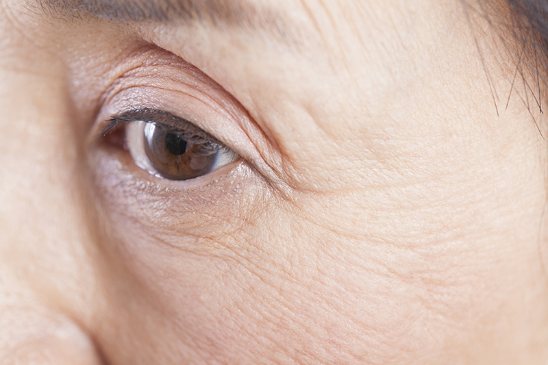 眼瞼痙攣（がんけんけいれん）