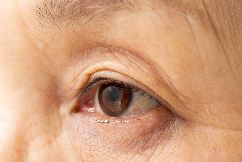 安心の設備と丁寧な対応で行う、日帰り白内障手術