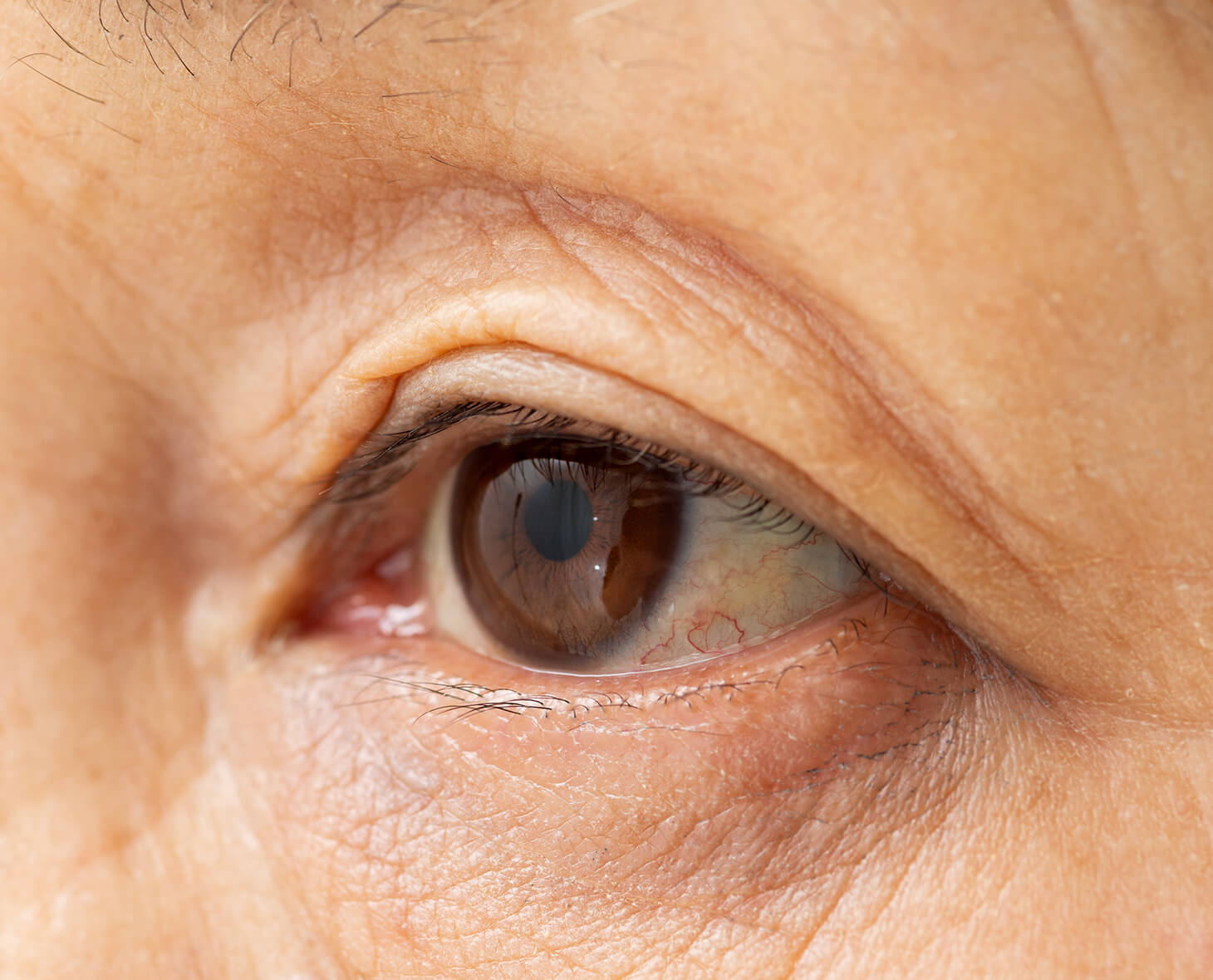 白内障の日帰り手術を開始